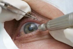 Cirurgia que altera cor do olho tem uso restrito para pessoas cegas