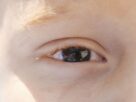 Cartilha sobre saúde ocular na infância orienta pais e professores